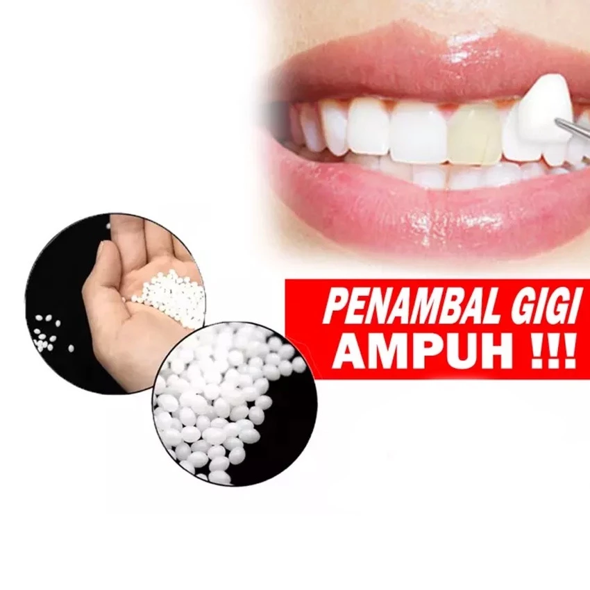50 Butir Penambal Gigi Ompong Temptooth Murah Gigi Palsu Penutup Gigi Patah Dan Berlubang | AutoStock