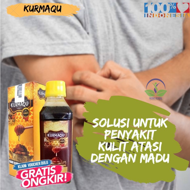 Jual Obat Gatal Prurigo Yg Diminum Solusi Penyakit Kulit Prurigo