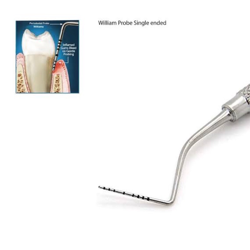 Jual Halodent Dental Sonde William Periodontal Probe Pocket Marker