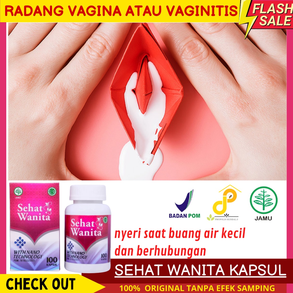 Jual Keputihan Berwarna Putih Atau Kuning Kehijauan Berbau Tidak Sedap Gatal Pada Area Vagina 5493