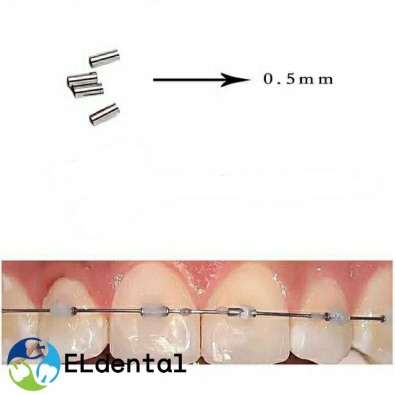 Jual Crimpable Mini Stopper Silinder Dental / Crimpable Stopper Ortho Shopee Indonesia