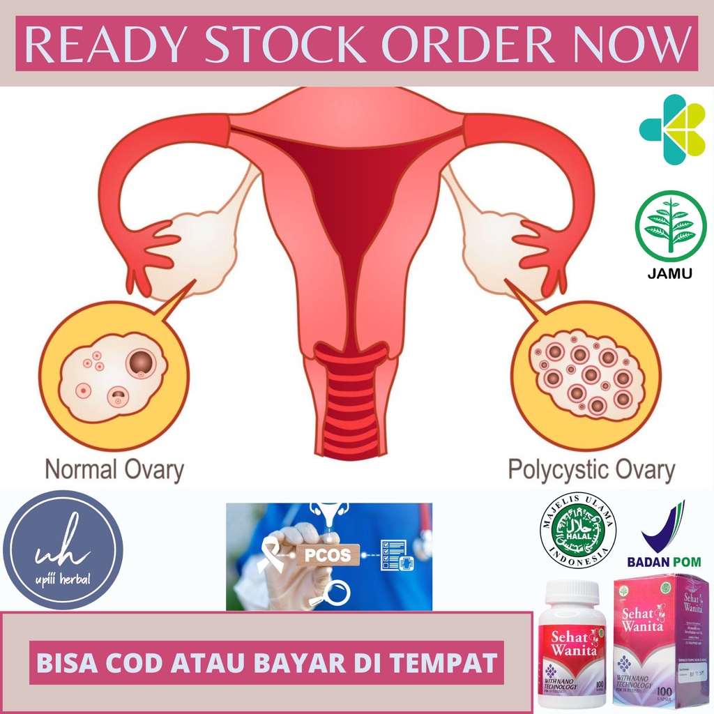 jual-obat-pcos-obat-untuk-pcos-obat-sindrom-ovarium-polikistik-obat