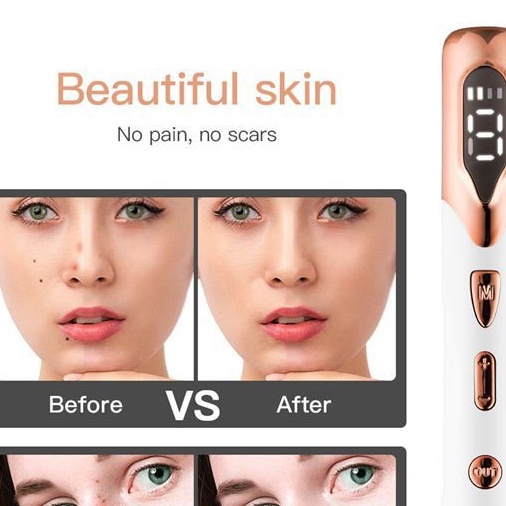 Jual Alat Laser Couter / Alat Laser Portabel / Alat laser tahi lalat ...