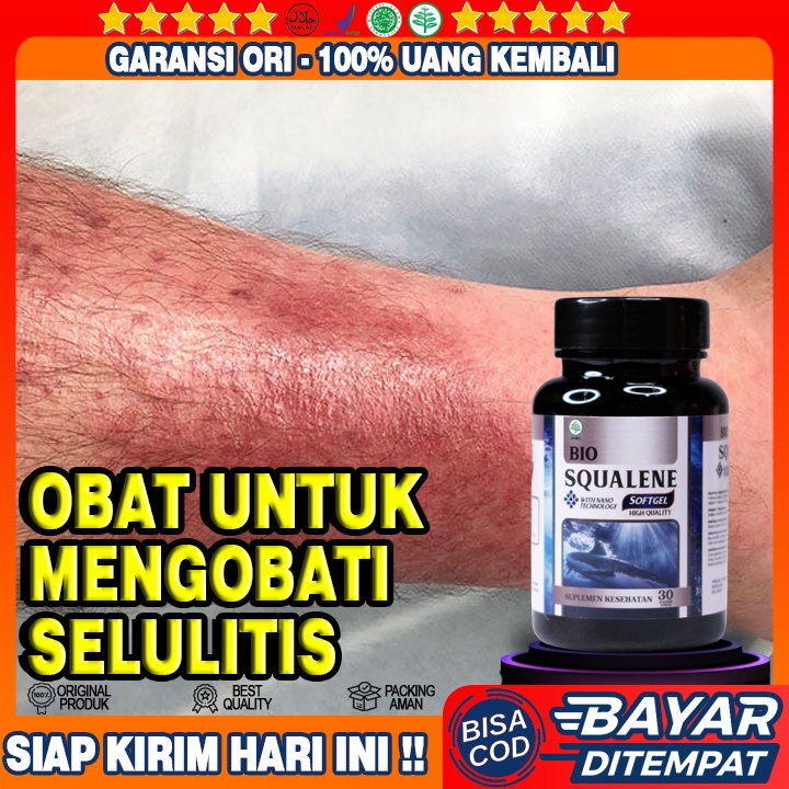 Jual Obat Selulitis Mengatasi Kulit Kemerahan Kemerahan Pada Paha