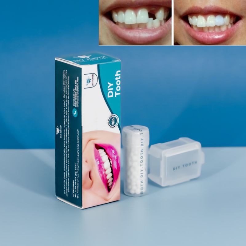 Promo 1000 Butir Temptooth Temp Tooth Lem Gigi Bahan Tambal Temporary  Diskon 42% di Seller Uhuru Shop - Wanasari, Kab. Bekasi