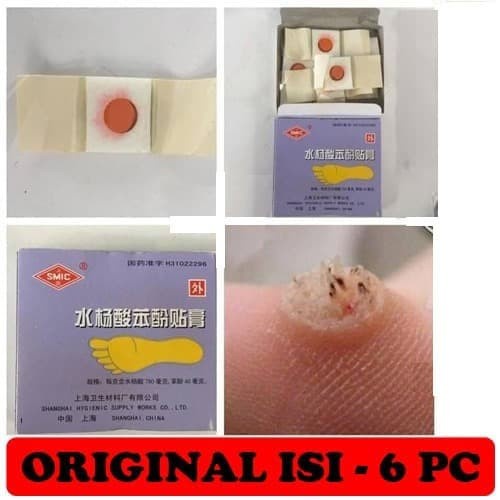 Jual Ss Plester Obat Kutil Mata Ikan Penutup Kutil Koyo Kutil Ji Yan Gao Isi Pcs Shopee