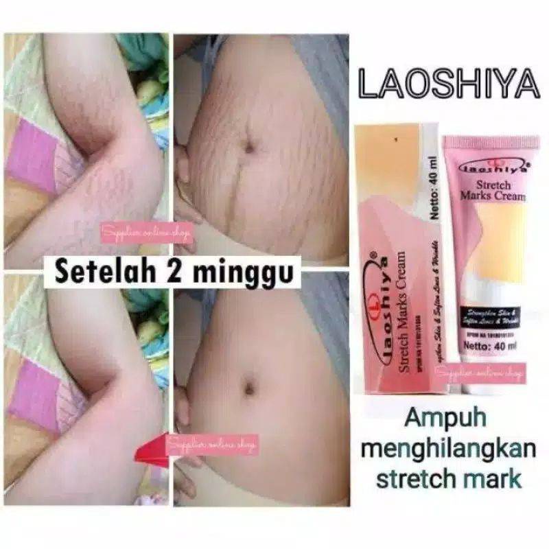 Jual Dermatix Ultra Gel Gr Cream Krim Obat Salep Penghilang Pemghilang Bekas Luka Hitam Koreng