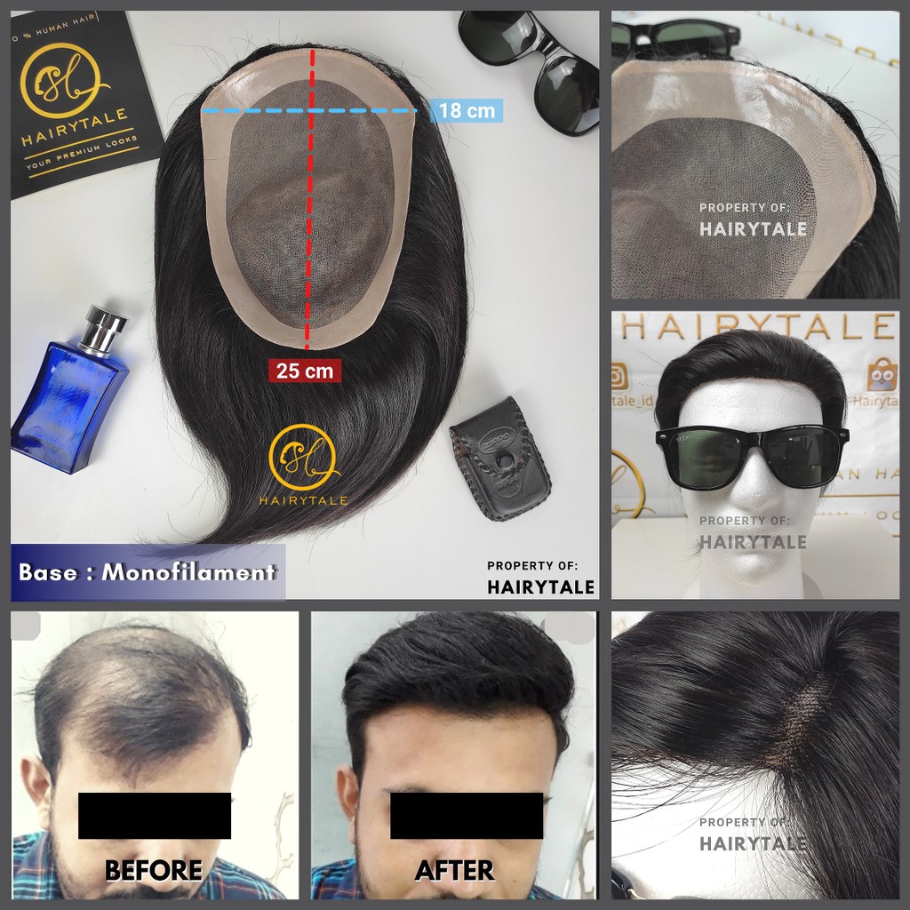 Jual Toupee / tutup botak pria, Monofilament, luas 25x18cm/custom size ...