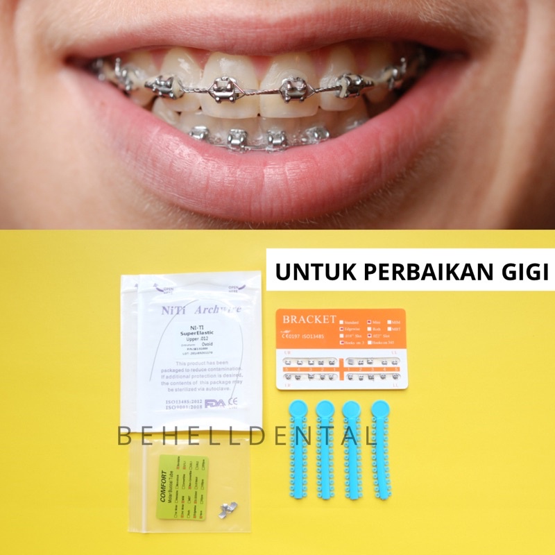 Jual PAKET BEHEL ORIGINAL PERMANEN METAL ORTHO BRACKET FANCY ORENS OREN ...