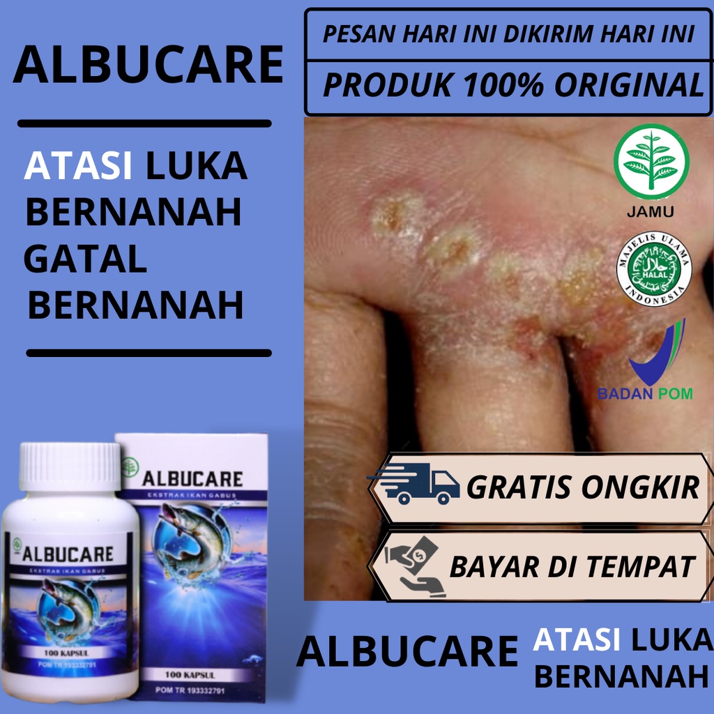 Jual Obat Luka Bernanah Gatal Bernanah Borok Bernanah Albucare