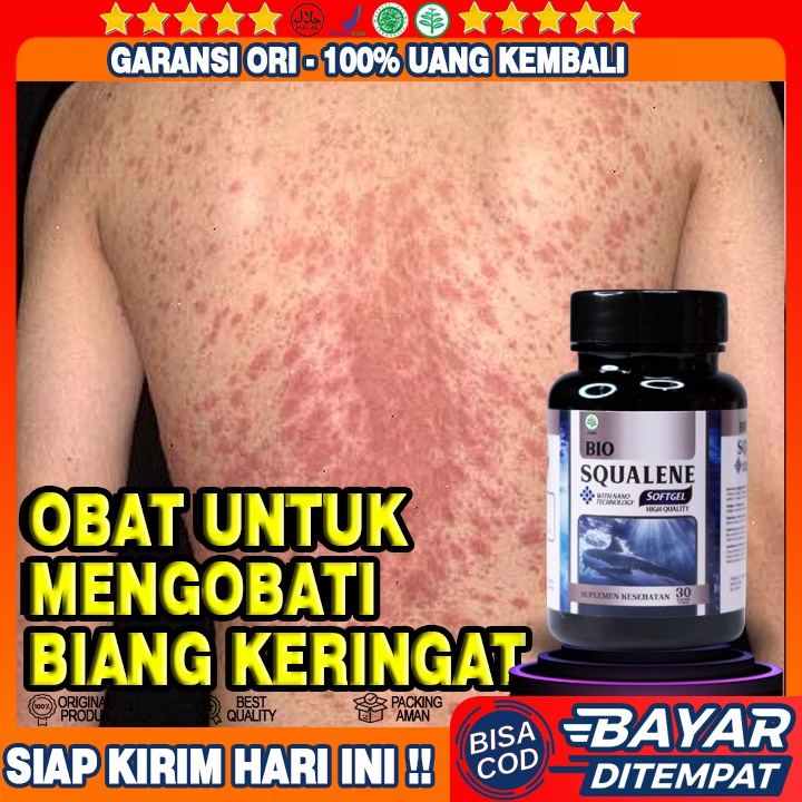 Jual Obat Biang Keringat Obat Biang Keringat Di Leher Obat Biang Keringat Gatal Gatal Obat 9583