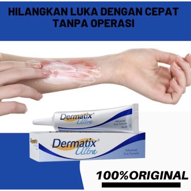 Jual Dermatix Ultra Gel Asli Promo Original Gr Salep