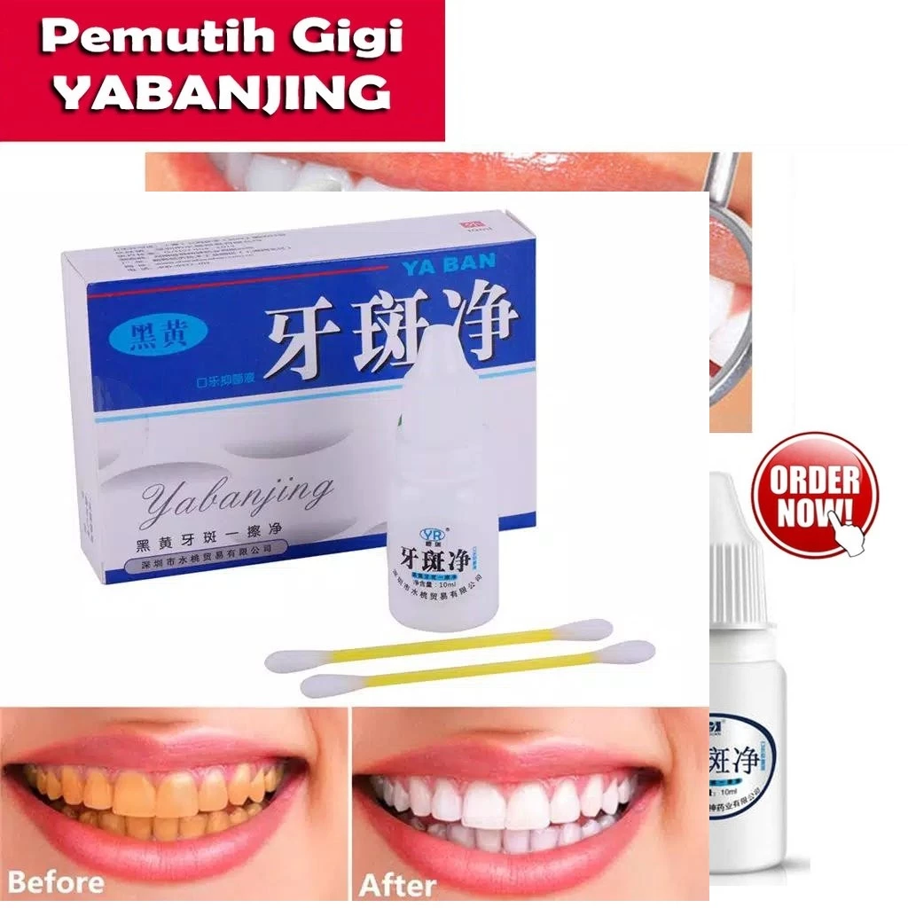 HOPE STORE - Pemutih Gigi Yabanjing Liquid Penghilang Noda Gigi AMPUH !!! | AutoStock