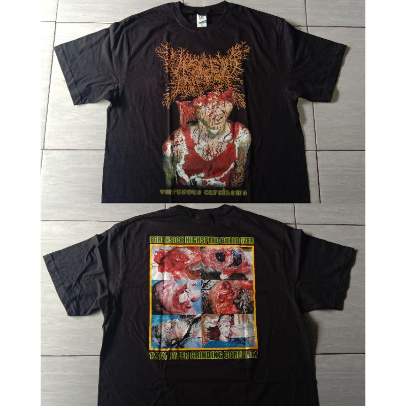 Viscera Infest – Verrucous Carcinoma（帯付） Viscera Infest – Verrucous Carcinoma（帯付） Esophageal