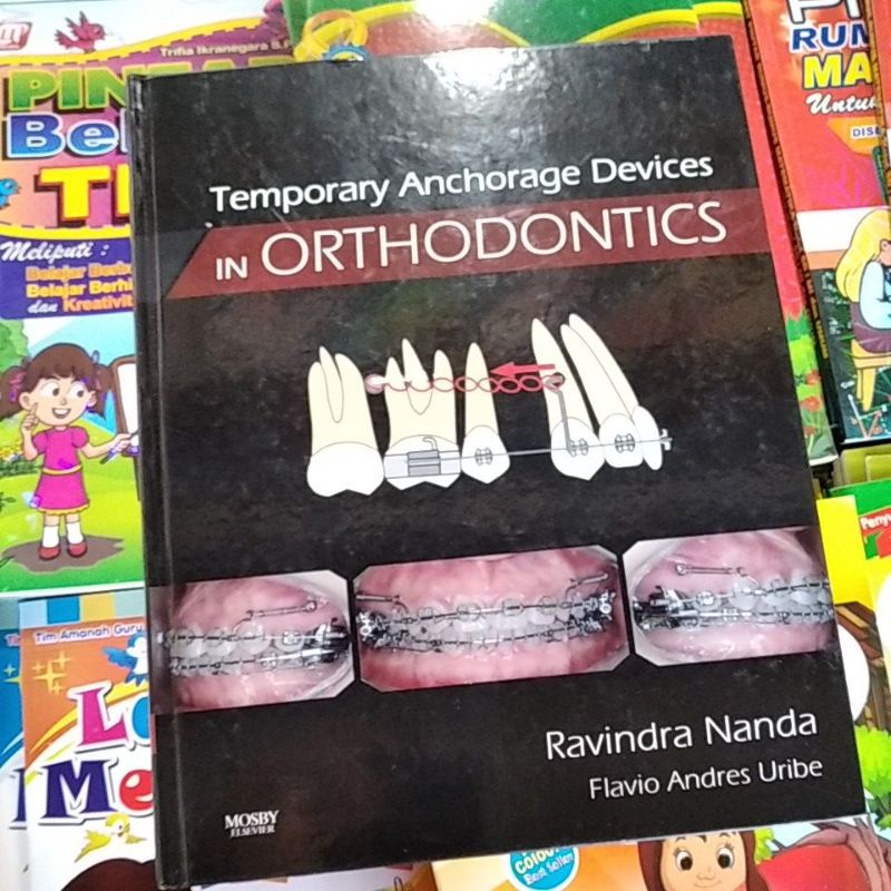 Jual temporary anchorage devices in orthodontics Shopee Indonesia