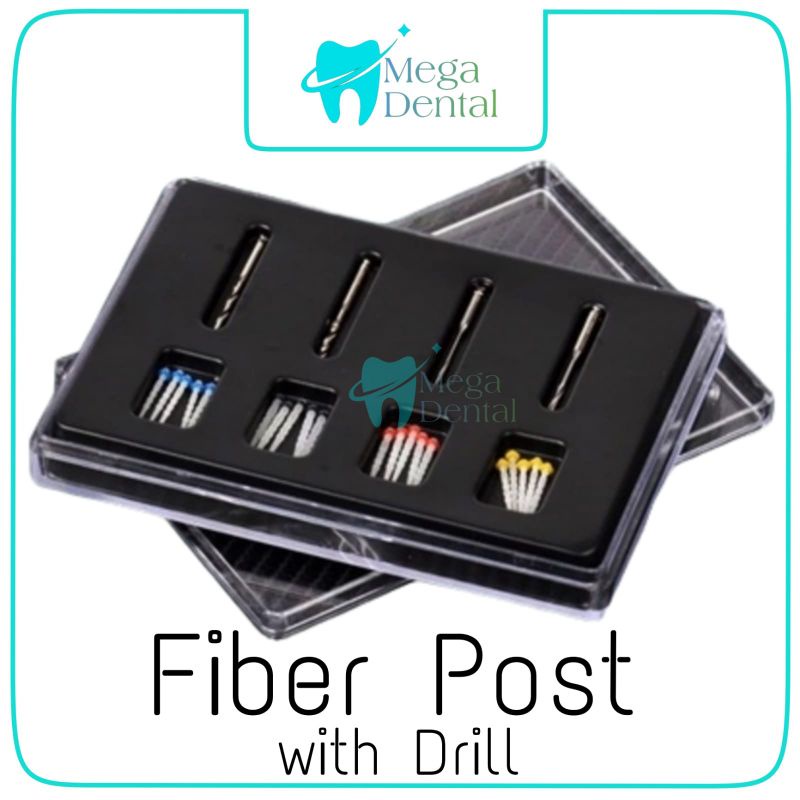 Jual DENTAL FIBER POST / DENTAL PASAK GIGI ENDODONTIC | Shopee Indonesia