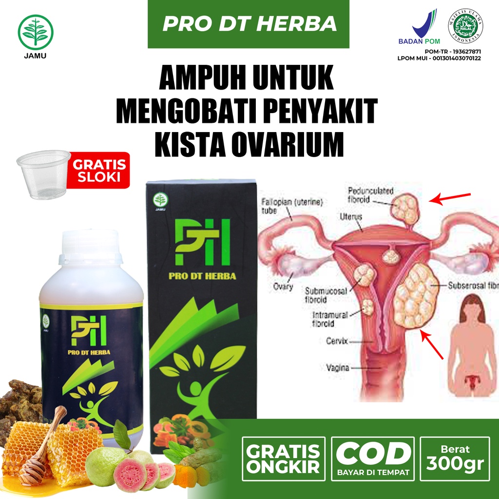 Jual Obat Kista Ovarium Kista Bartholin Ganglion Coklat