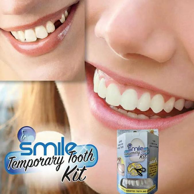 Jual Instant Smile Temporary Tooth Kit Replace A Missing Tooth In