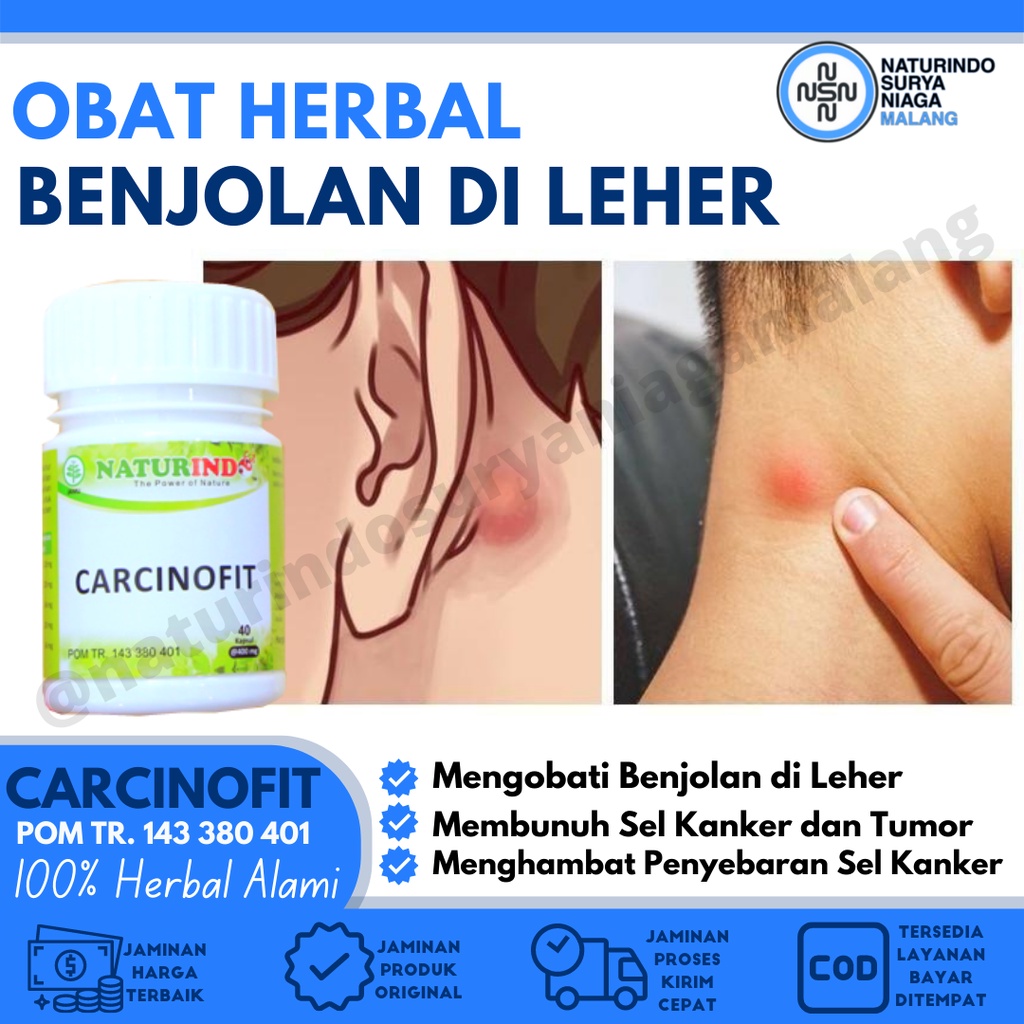 Jual Obat Benjolan Di Leher Obat Benjolan Obat Benjolan Payudara Obat Penghilang Benjolan Herbal