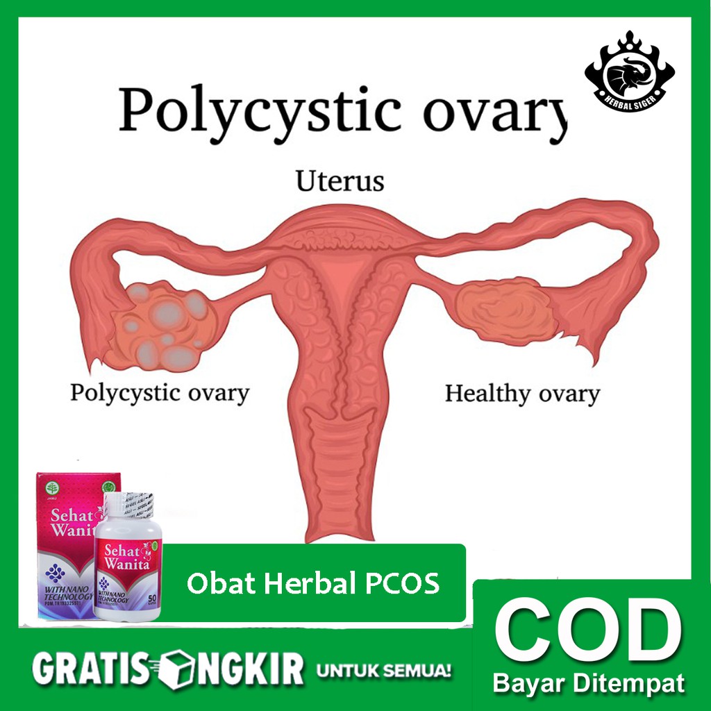 Jual Obat Herbal PCOS, Kista, Miom, Nyeri Haid, dan Masalah Kewanitaan ...