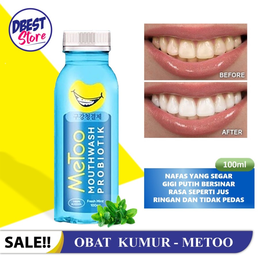 Jual [BPOM]100ML METOO MOUTHWASH FRESH MINT / OBAT KUMUR PROBIOTIK