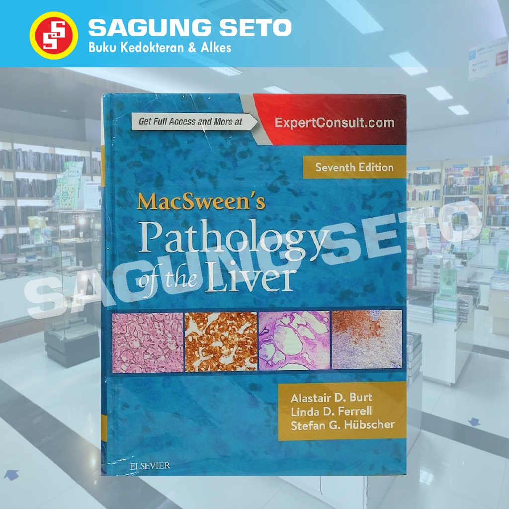 Jual MACSWEEN PATHOLOGY OF THE LIVER 7ED - BURT / PATOLOGI | Shopee ...