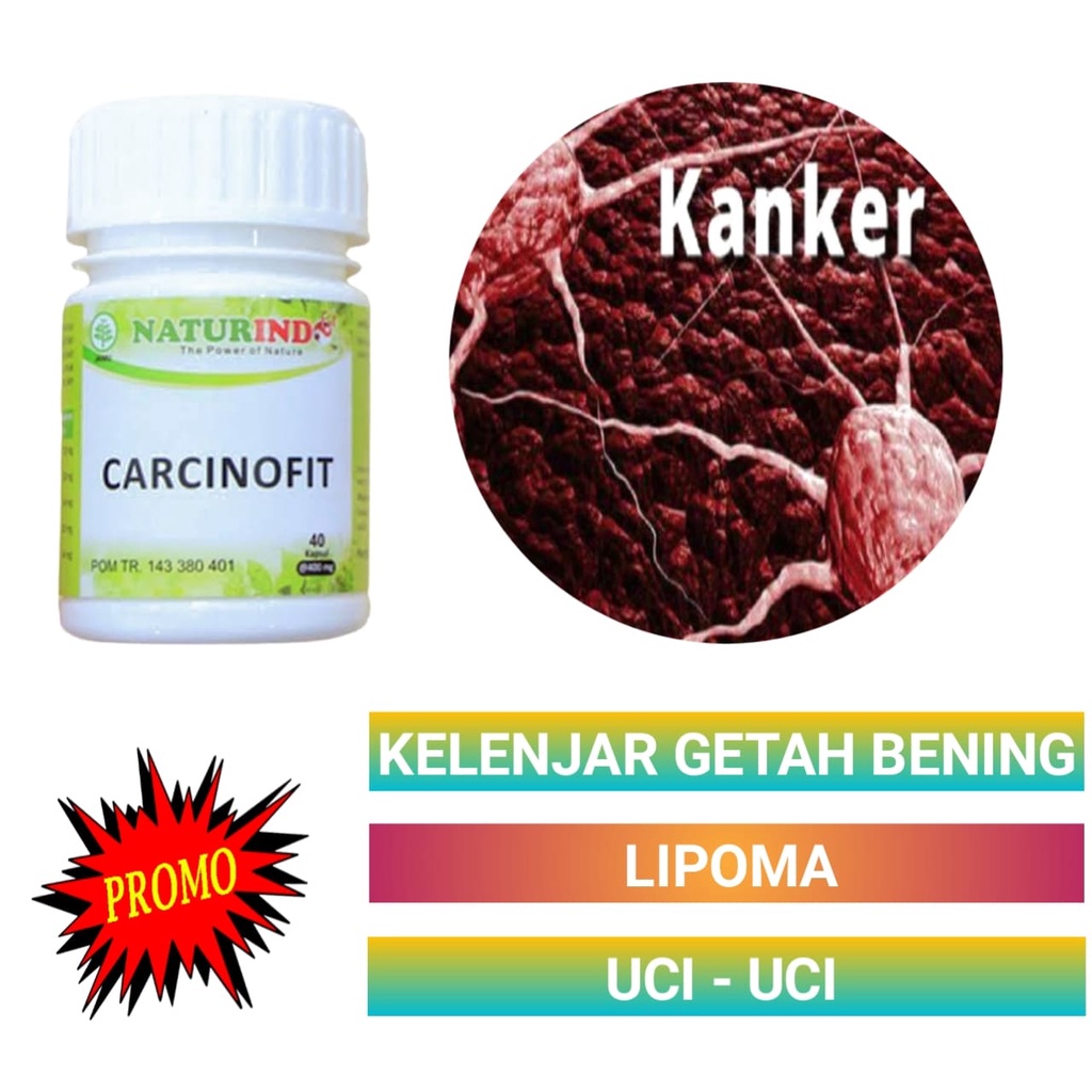 Jual Obat Kelenjar Getah Bening Sel Kanker Lipoma Uci-Uci Benjolan Di ...