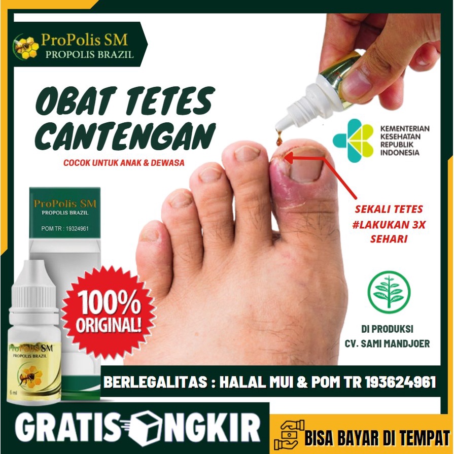 Jual Obat Tetes Cantengan Jempol Kaki And Tangan Bengkak And Bernanah