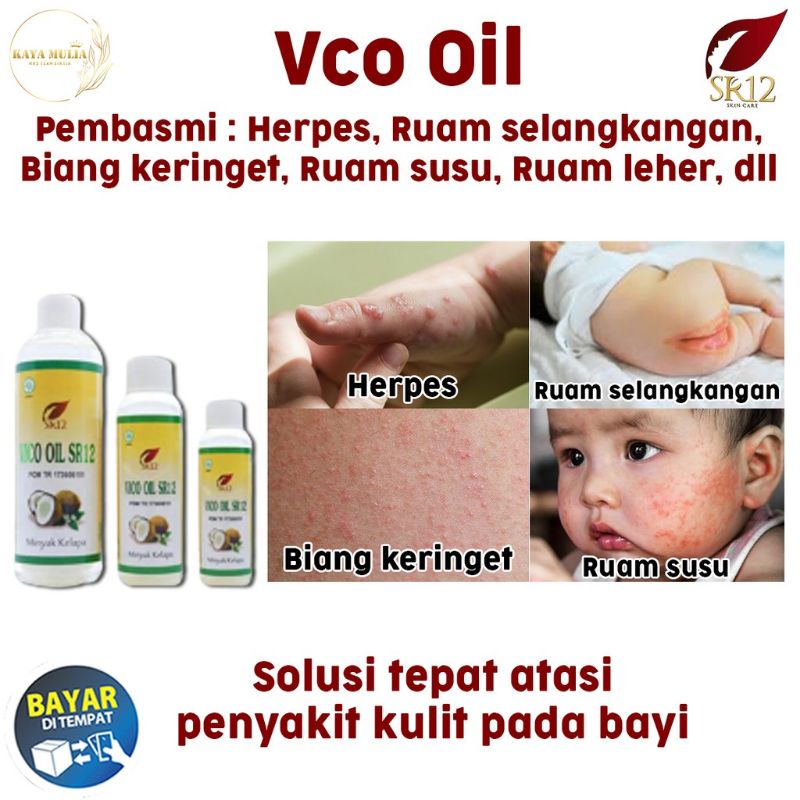 Jual Ampuh!!!! Obat Ruam Kulit Bayi/Ruam Popok Bayi/Vico Oil Sr12 ...