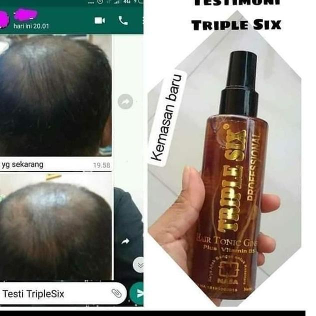 Jual Skip Aja!! Triple Six Nasa Hair Tonic Gingseng Serum Penumbuh ...