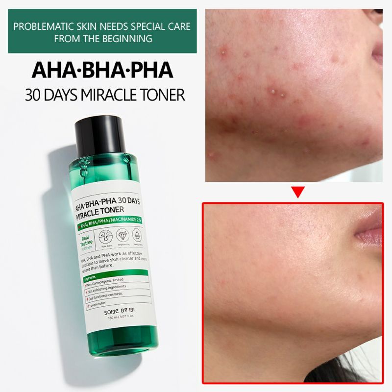 Jual SOME BY MI AHA BHA PHA 30 DAYS MIRACLE TONER 150ml | Shopee Indonesia