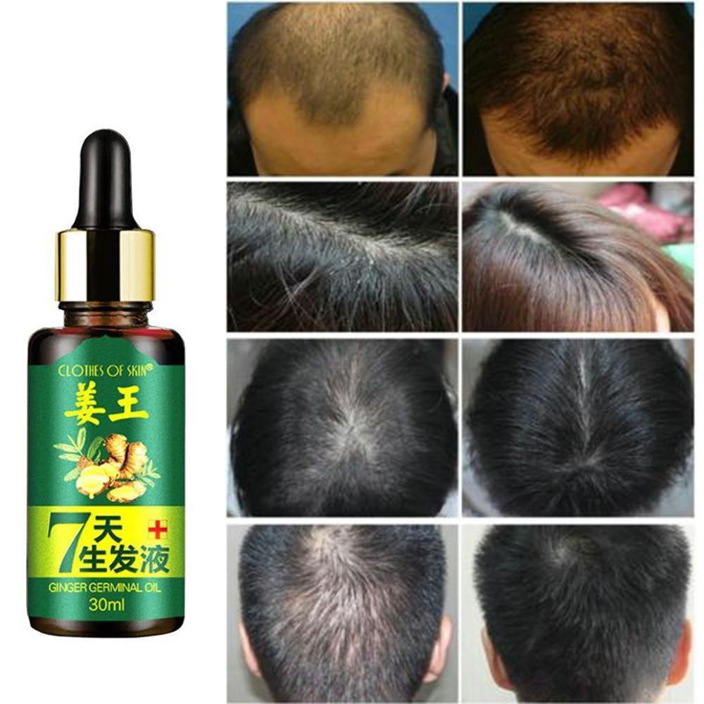 Jual GINGER KING OIL 30ml Clothes of Skin Ginger Germinal Oil Minyak