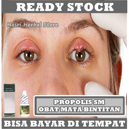 Jual Obat Mata Bintitan - Obat Bintitan di Bawah Mata, Obat Kalazion ...