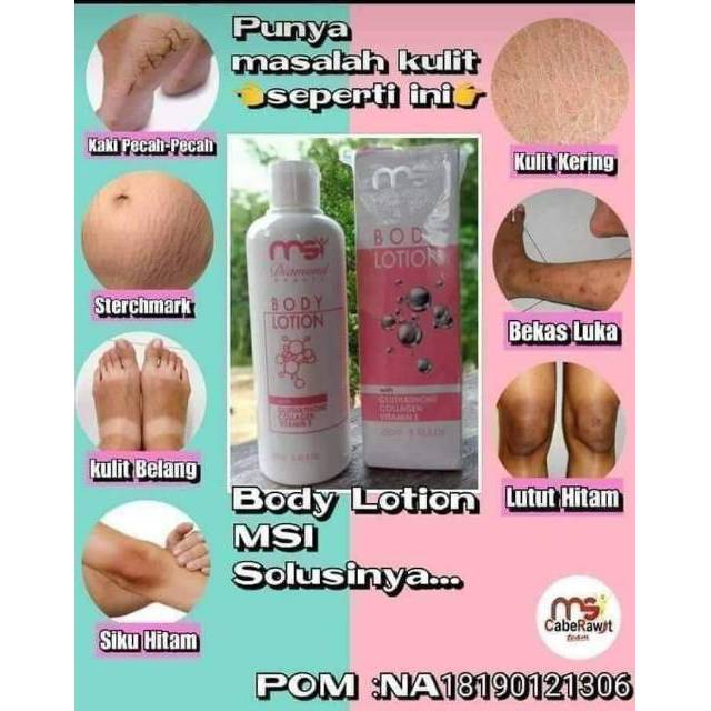 Jual Hand Body Lotion Olive Oil Msi Mencerahkan Tubuh Memudarkan