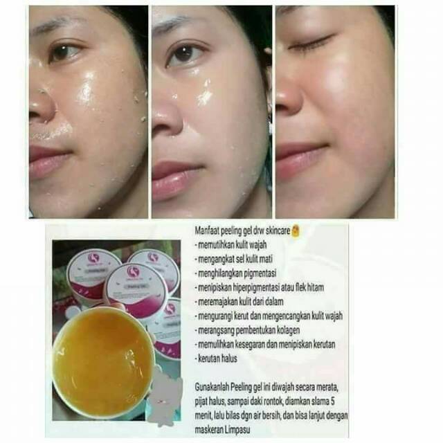 Esthefact GD Peeling Gel N 2本セット エステファクト GDピーリングジェル N: 角質ケア たかの友梨