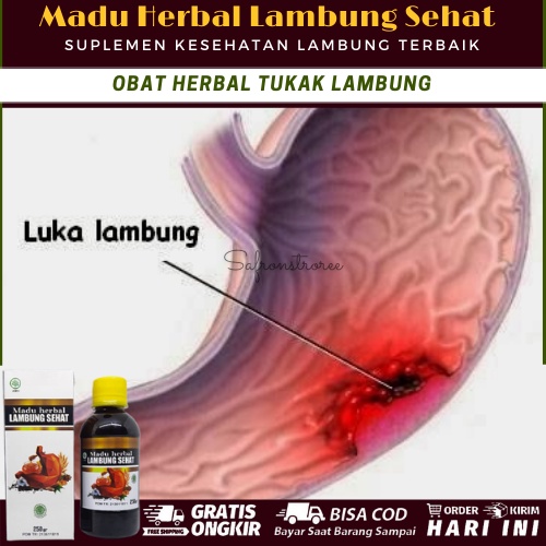 Jual Obat Herbal Tukak Lambung, Luka Pada Dinding Lambung, BAB Berdarah ...