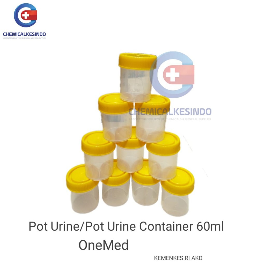 Jual Urine Container Non Steril - Pot Urin 60ml | Shopee Indonesia