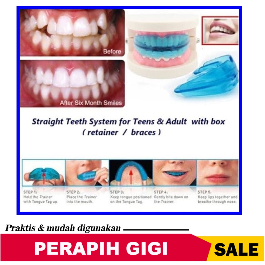 Jual Teeth Trainer Allignment Orthodontic ORIGINAL Alat Perapih Gigi ...