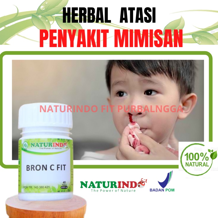 Jual Obat Mimisan Anak Dan Dewasa Herbal Atasi Sinusitis Pendarahan