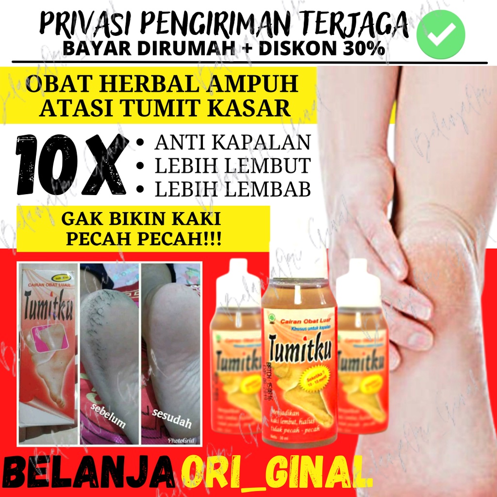 Jual Penghalus Tumit Tumitku Obat Herbal Mengatasi Kaki Pecah Pecah 30ml Original Bpom Shopee 1317