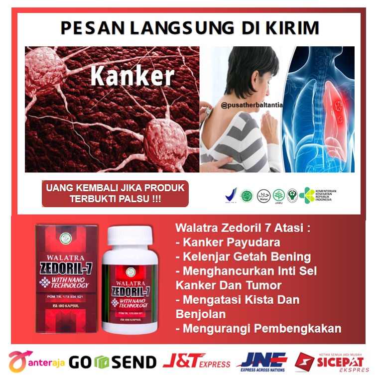 Jual Obat Herbal Kanker Tumor Ganas Tumor Jinak Benjolan Kelenjar Getah