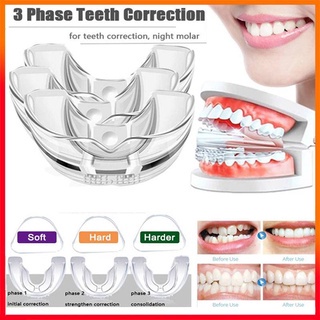 Jual (Tanpa Box) Alat Perapih Gigi Behel Perata Gigi Lepas Pasang Teeth ...
