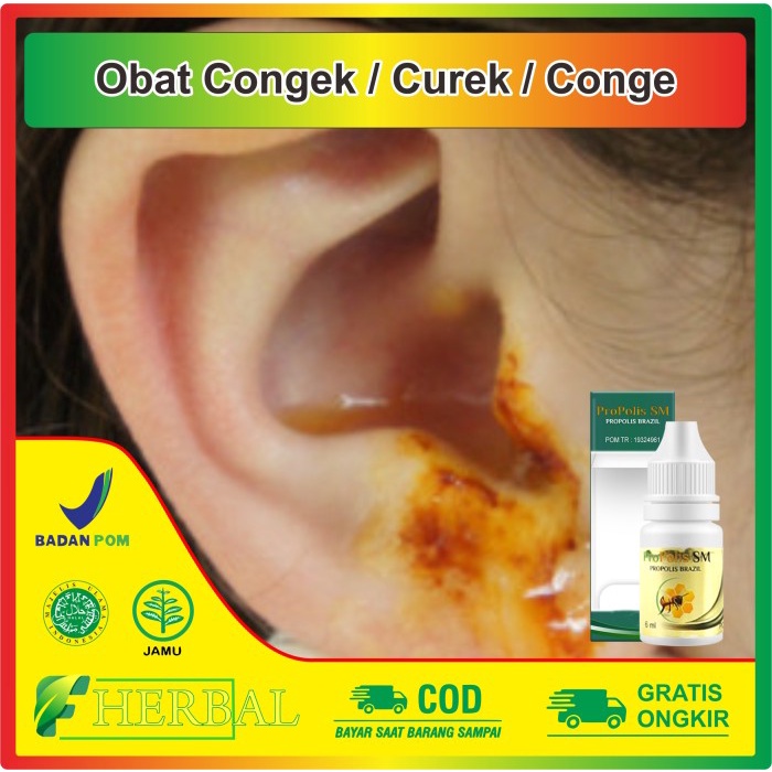 Jual Obat Telinga Congek Congea Curek Bernanah Conge Berair