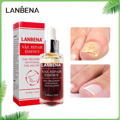 Jual Lanbena Nail Repair Essence Oils Serum Vitamin Kuku Anti Jamur