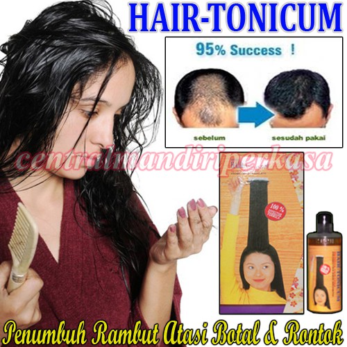 Jual Nutrisi Penghilang Kebotakan Penambah Cairan Penumbuh Rambut Obat ...