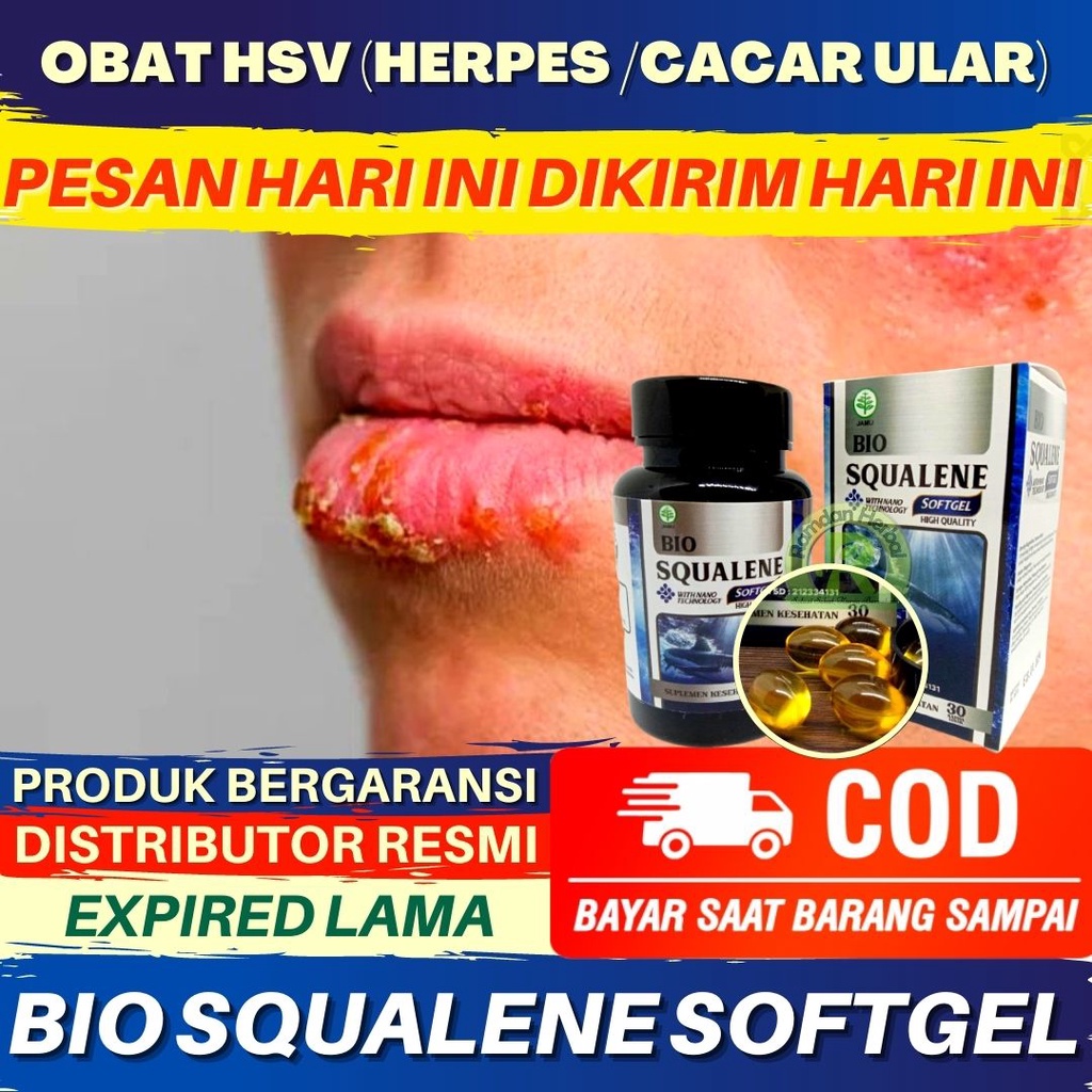 Jual Obat Hsv Obat Cacar Ular Obat Virus Simplex Obat Herbal Herpes