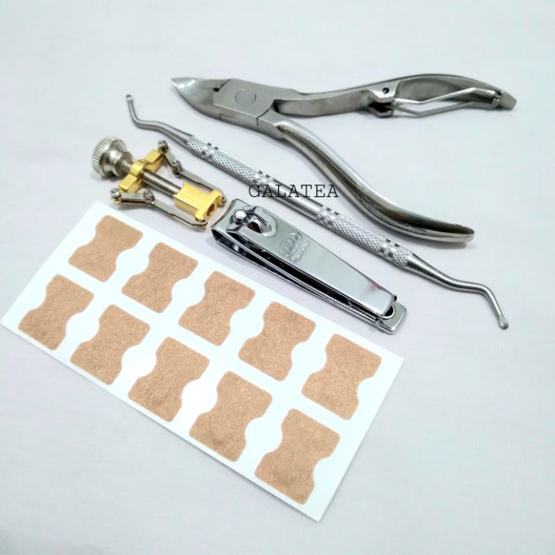 Jual in grown toe nails correction/korektor kuku cantengan/gunting