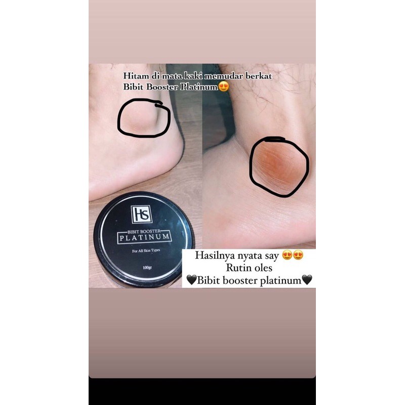 Jual Booster platinum | Shopee Indonesia
