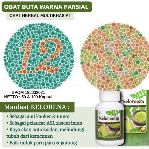 Jual Obat Buta Warna Parsial Vitamin Mata Buta Warna Parsial Mencegah
