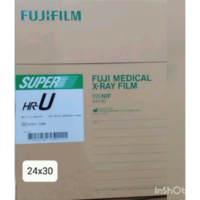 Jual Film Rontgen##Filmronsen #Filmrontgen #Ronsen #Rontgen # ...